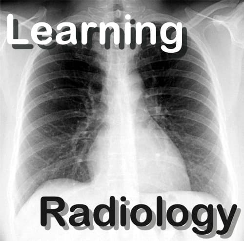 LearningRadiology Video Podcasts cover