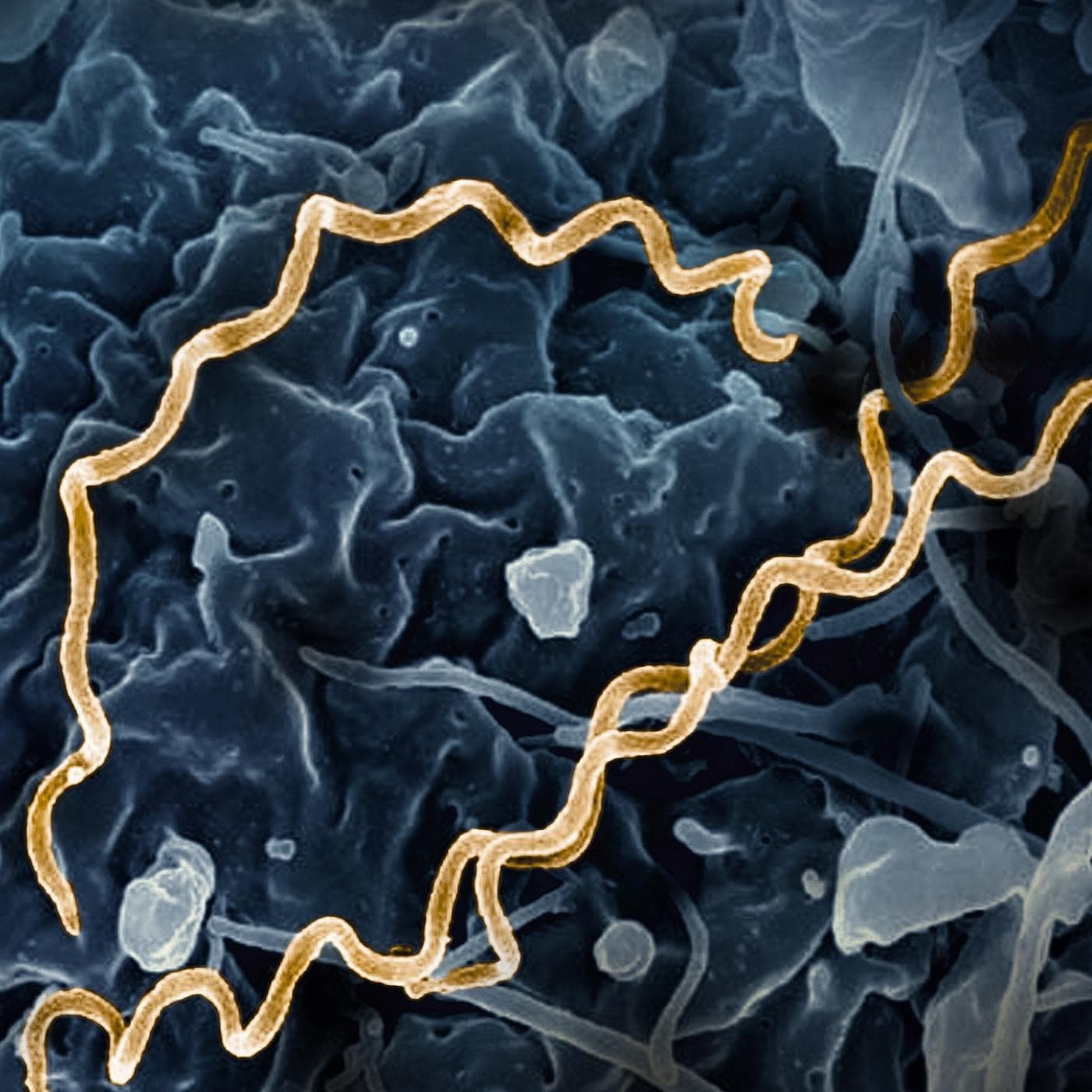 Syphilis: The Great Masquerader - EMplify by EB Medicine cover