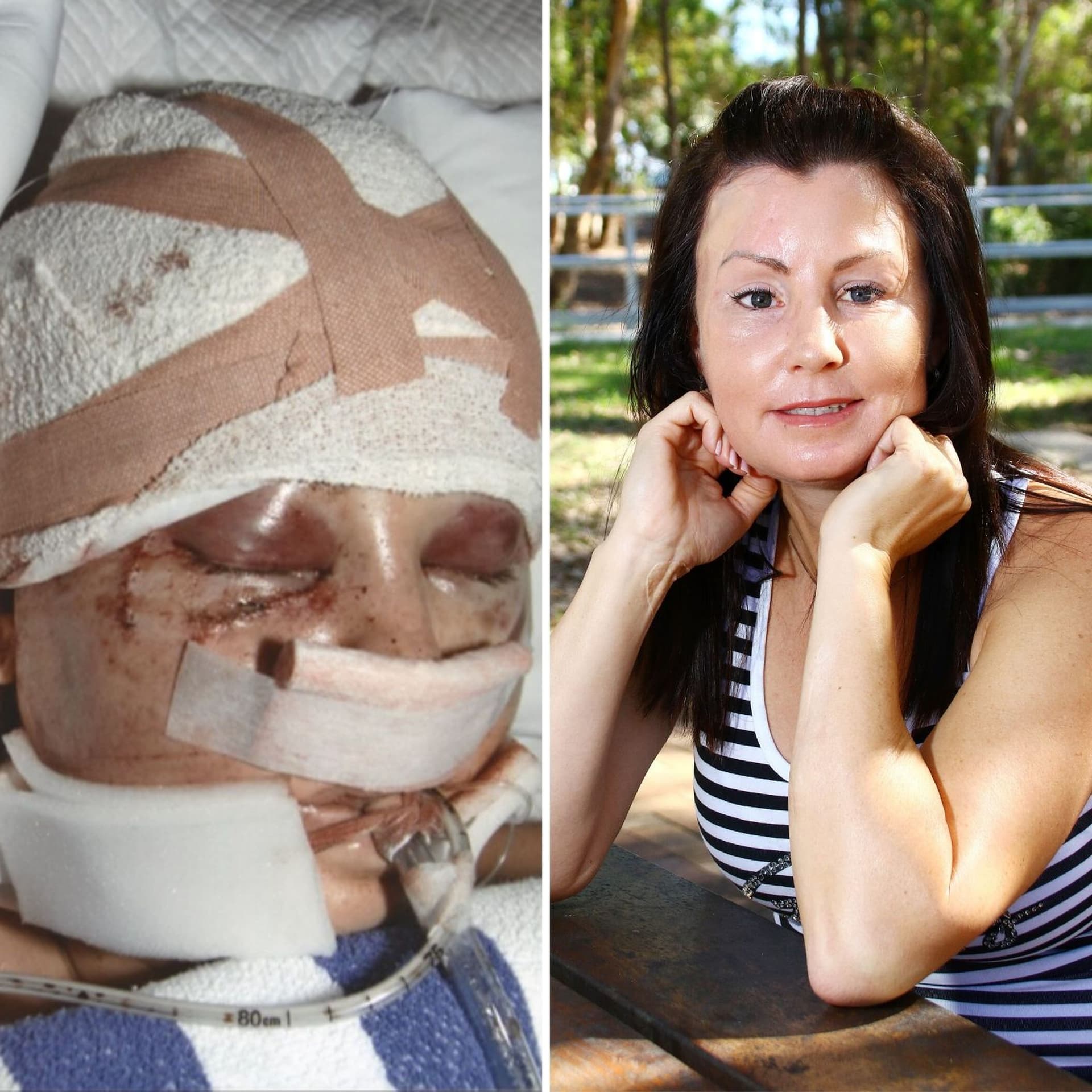 "I was bashed with a baseball bat" - How I Survived cover