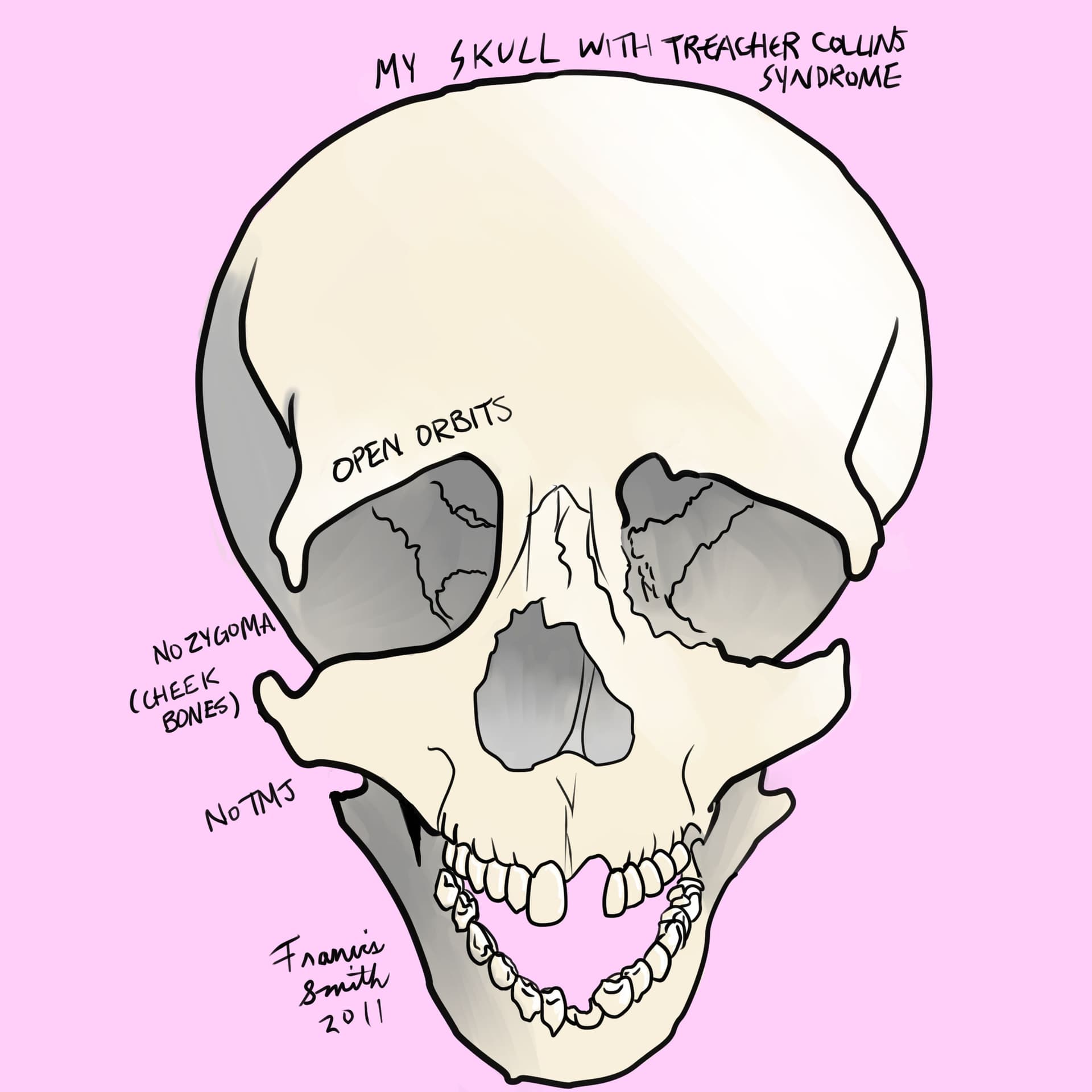 Episode 1 - About Face - Bone Lab Radio cover