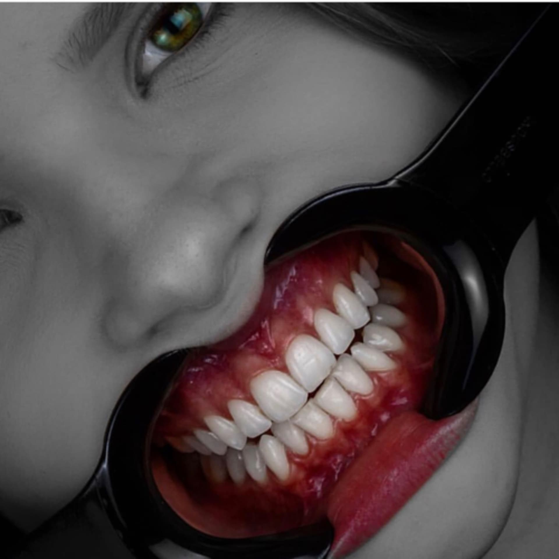 68- Shade matching in esthetic dentistry - Dentcast cover