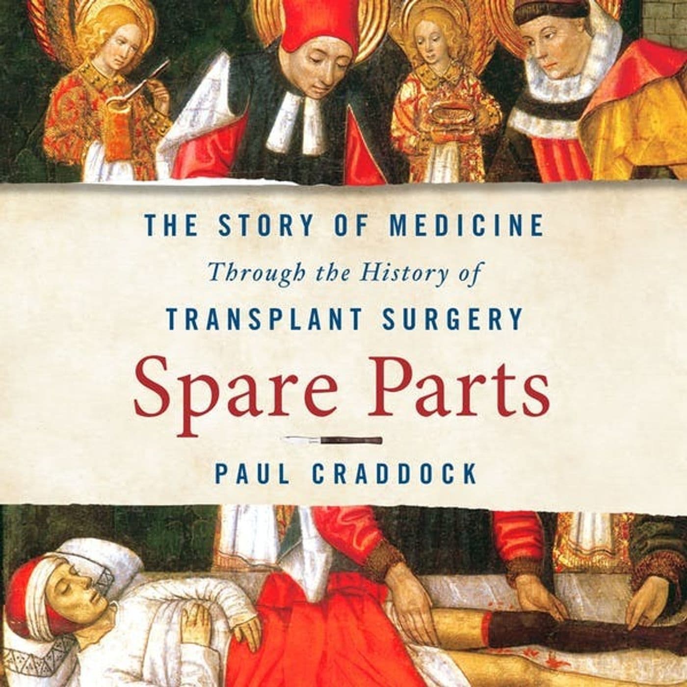 The History of Transplant Surgery - Ask Science cover