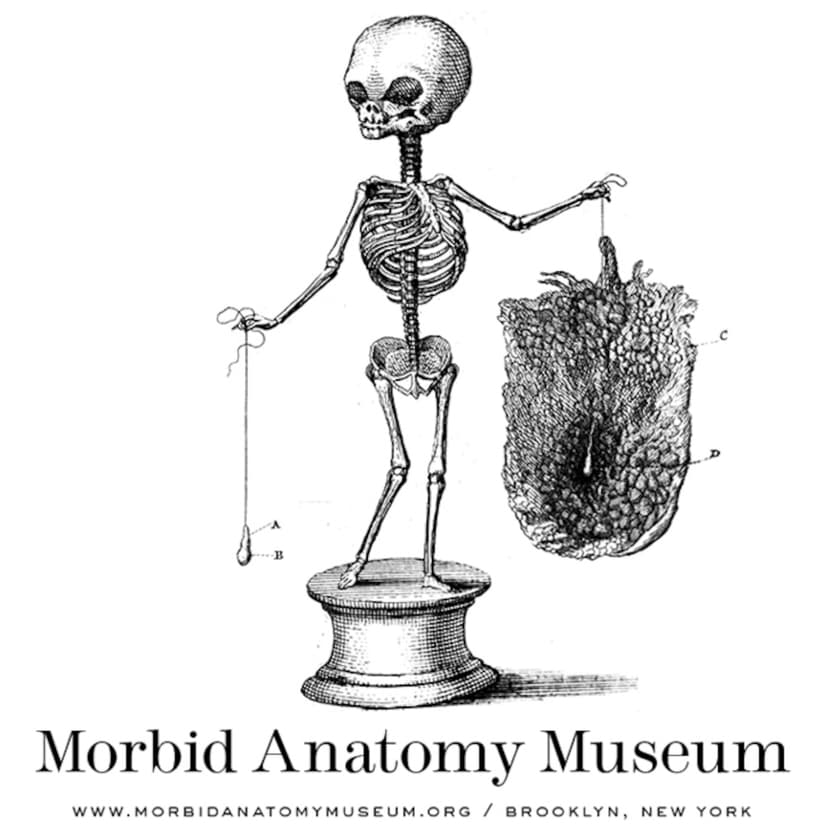 The Morbid Anatomy Transmission cover