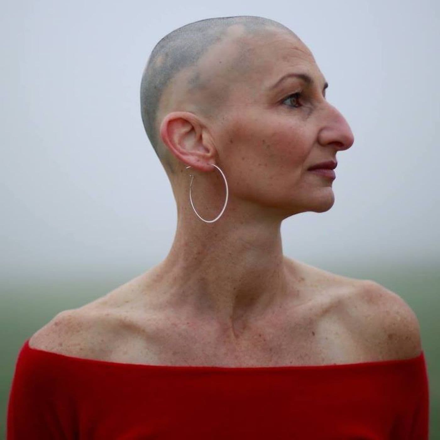 46: Bald & Beautiful: Redefining Body Image After Hair Loss — Therapy Rocks! cover