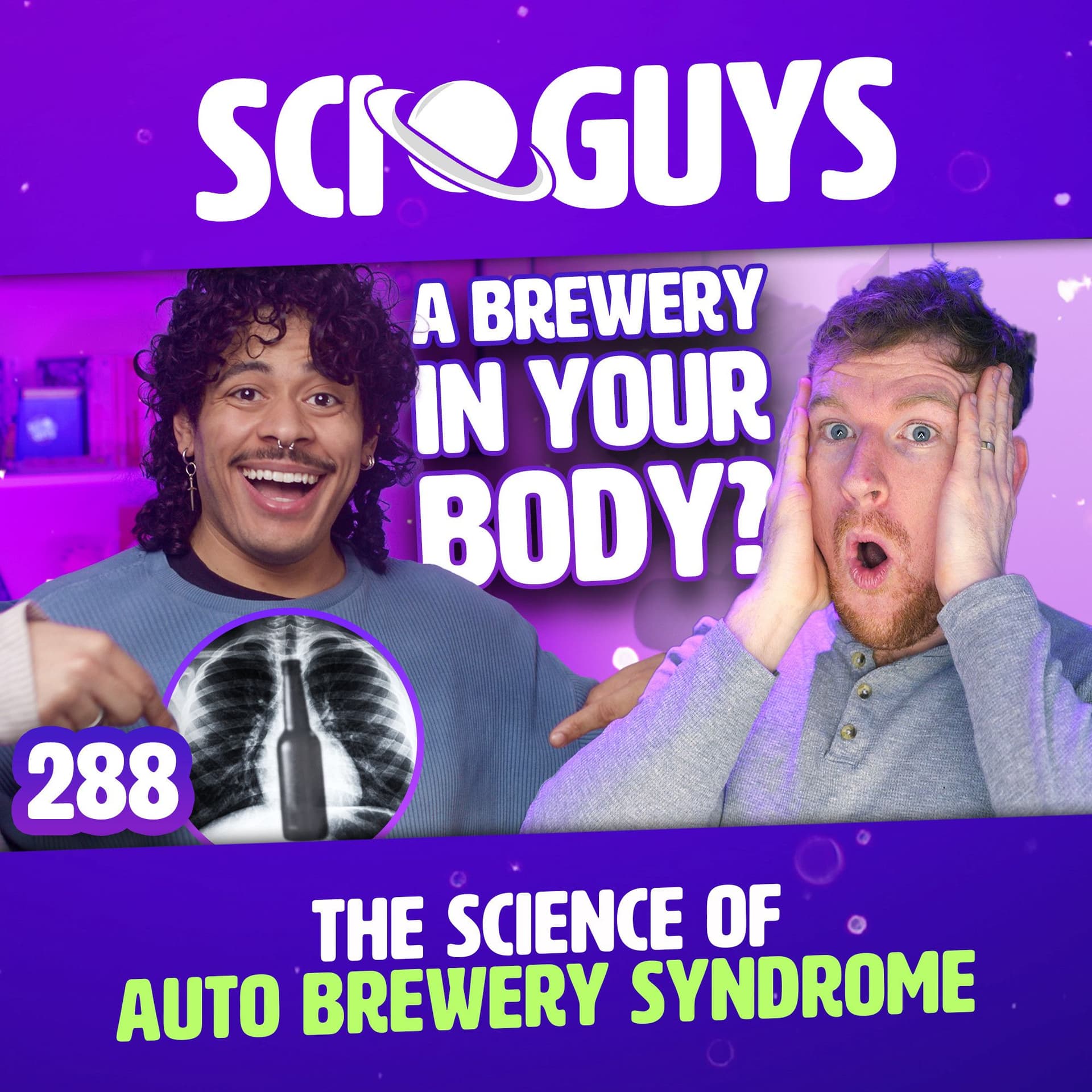 288: The Science of Auto Brewery Syndrome - Sci Guys cover
