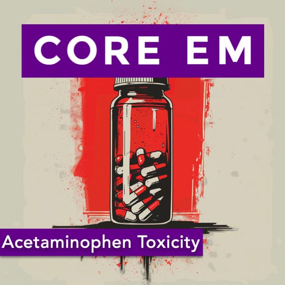 Episode 203: Acetaminophen Toxicity - Core EM - Emergency Medicine Podcast cover