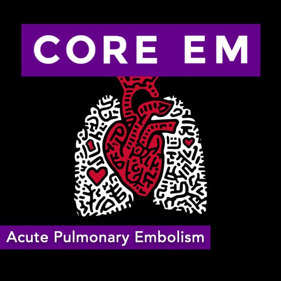 Episode 214: Acute Pulmonary Embolism - Core EM - Emergency Medicine Podcast cover