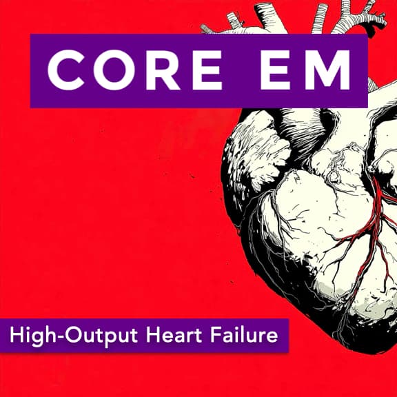 Episode 221: High-Output Heart Failure - Core EM - Emergency Medicine Podcast cover