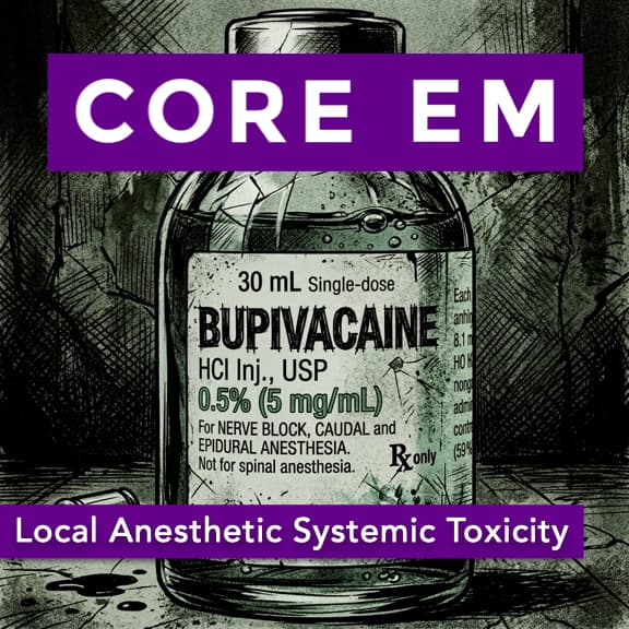Episode 222: Local Anesthetic Systemic Toxicity (LAST) - Core EM - Emergency Medicine Podcast cover