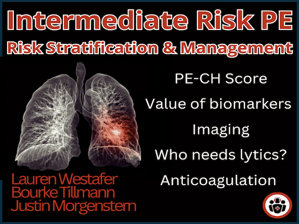 Ep 203 Intermediate Risk Pulmonary Embolism Risk Stratification, Management and Algorithm - Emergency Medicine Cases cover