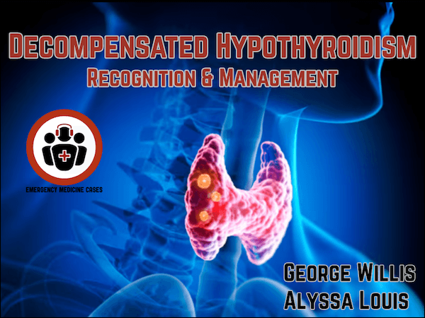 Ep 210 Decompensated Hypothyroidism Recognition and Management - Emergency Medicine Cases cover