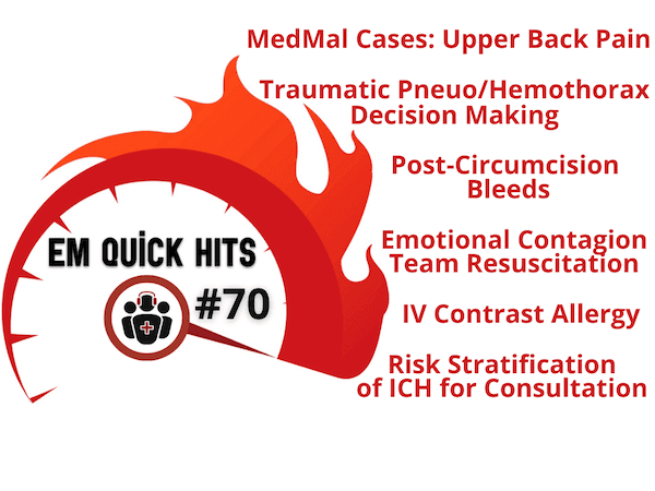 EM Quick Hits 70 MedMal Cases Upper Back Pain, Traumatic Pneumothorax/Hemothorax Decision Making, Risk Stratification of ICH for Consultation, Post-Circumcision Bleeds, IV Contrast Allergy, Emotional Contagion - Emergency Medicine Cases cover