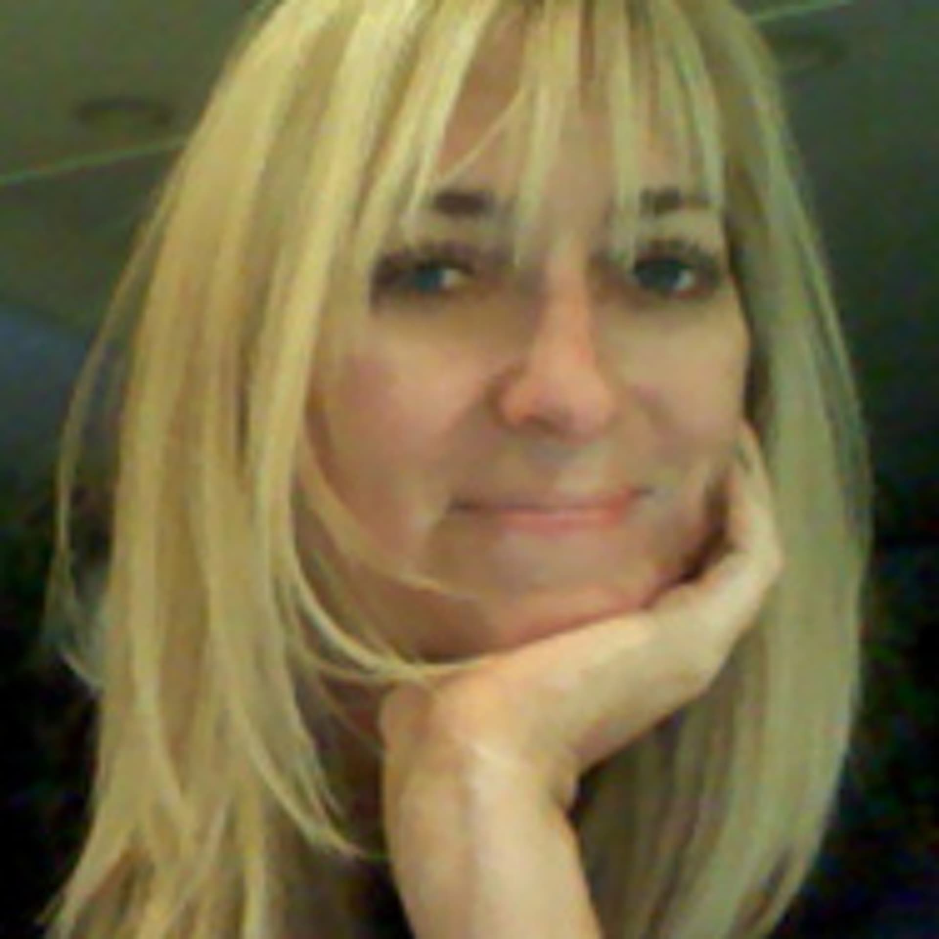 Can ginger root repigment vitiligo Day 4 - nathaliep cover