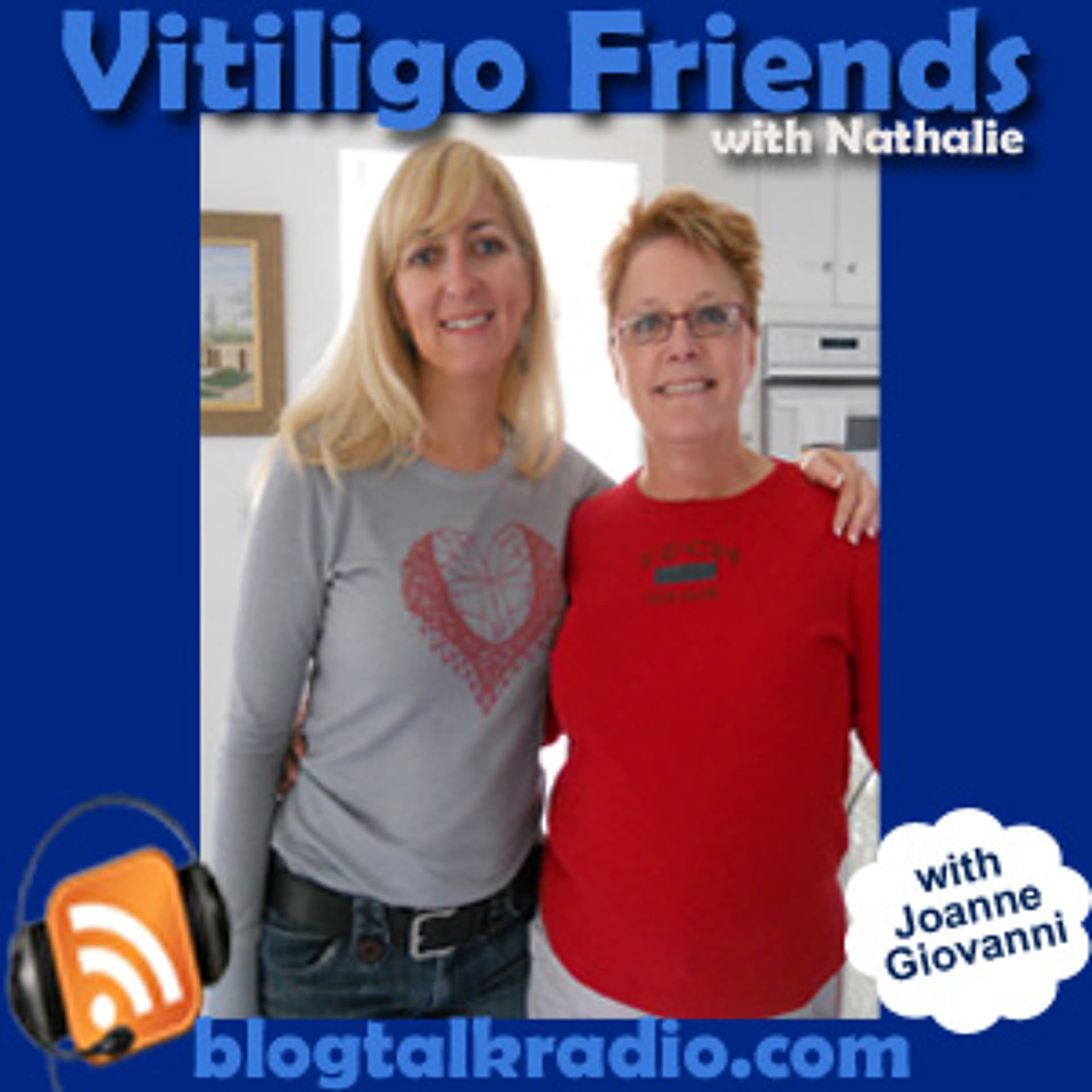 Can Ginger Root Repigment Vitiligo Day 20 - nathaliep cover
