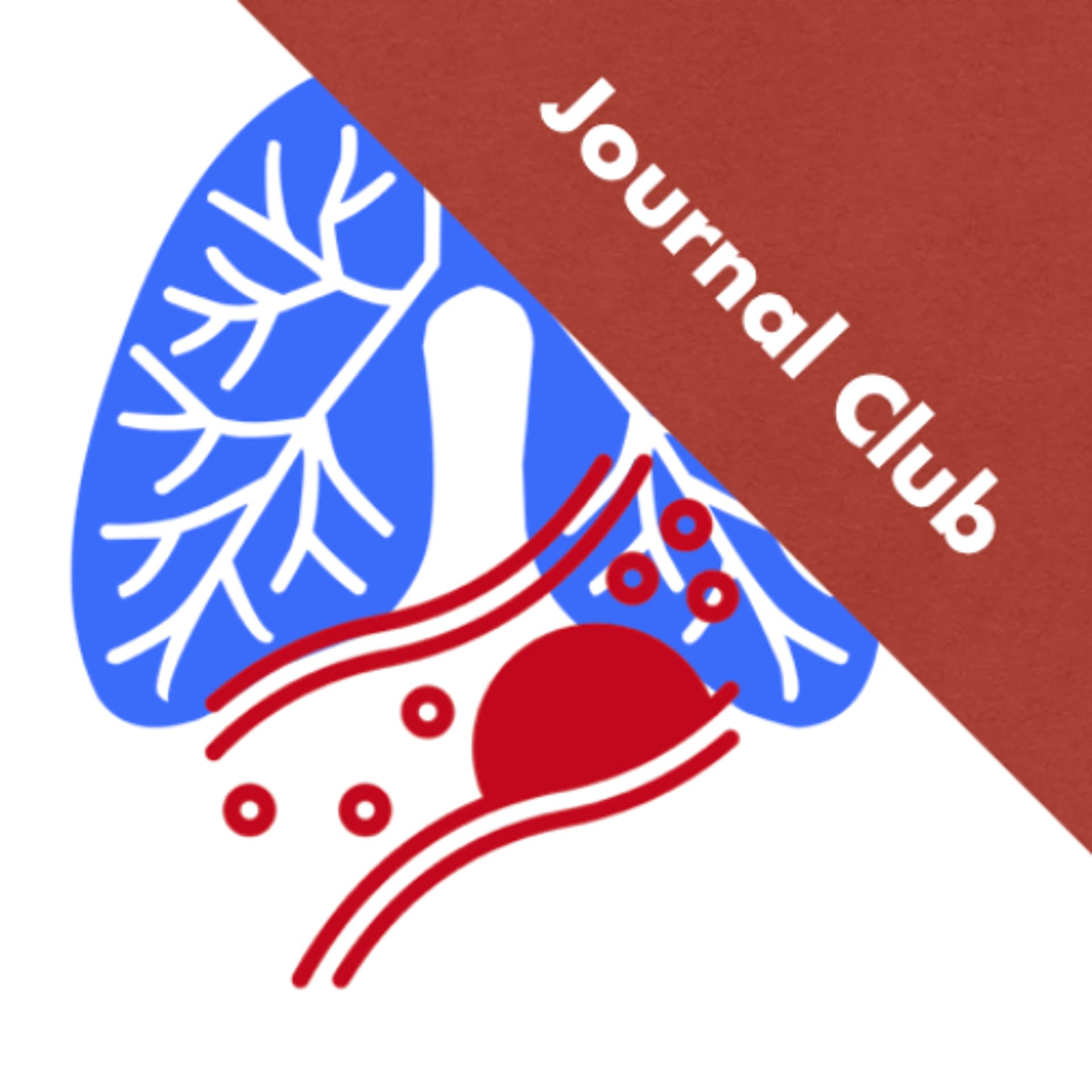 Can D-dimer be Used and Useful in High Pre-Test Probability PE Patients? - TamingtheSRU cover