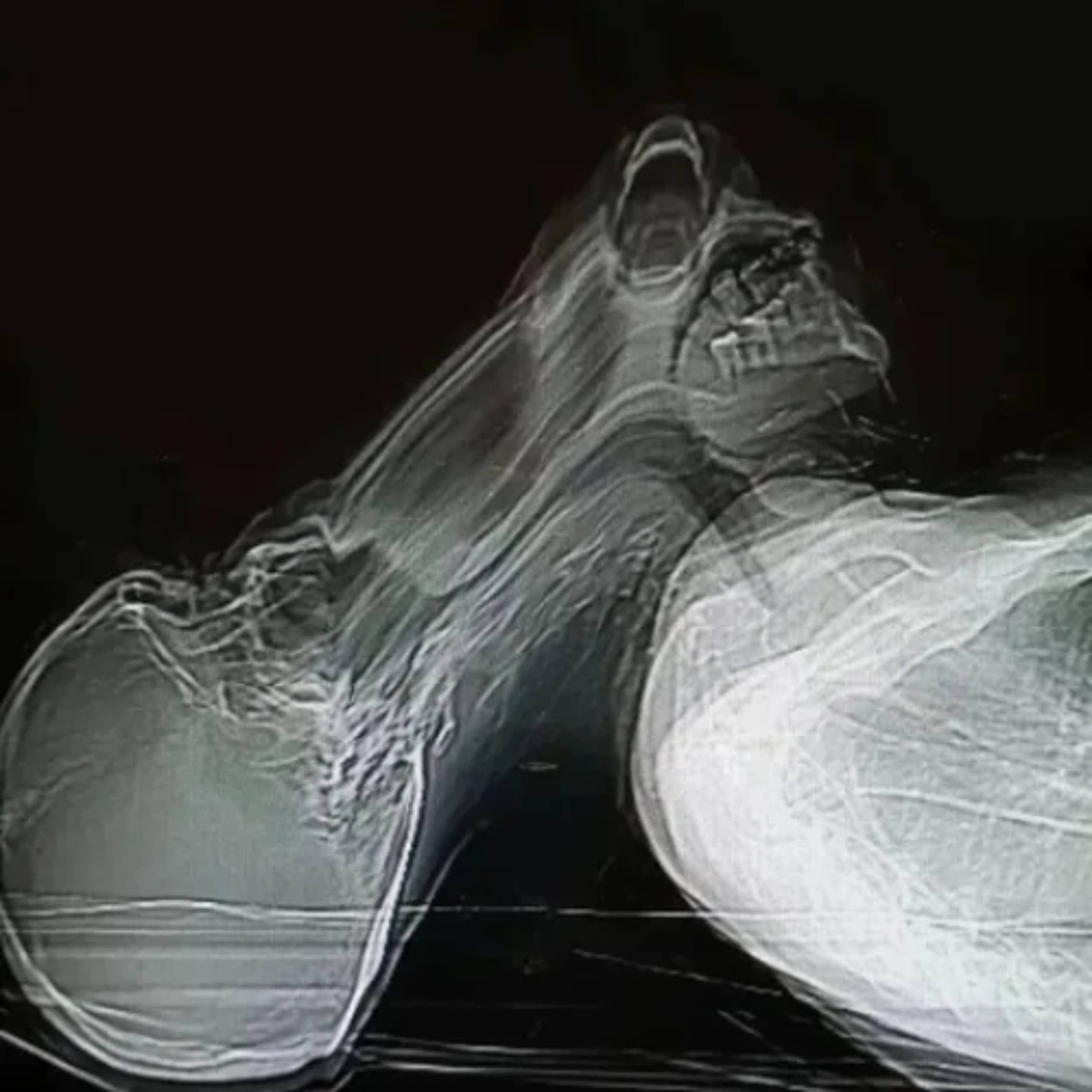 Diversion - Savoyivok cover