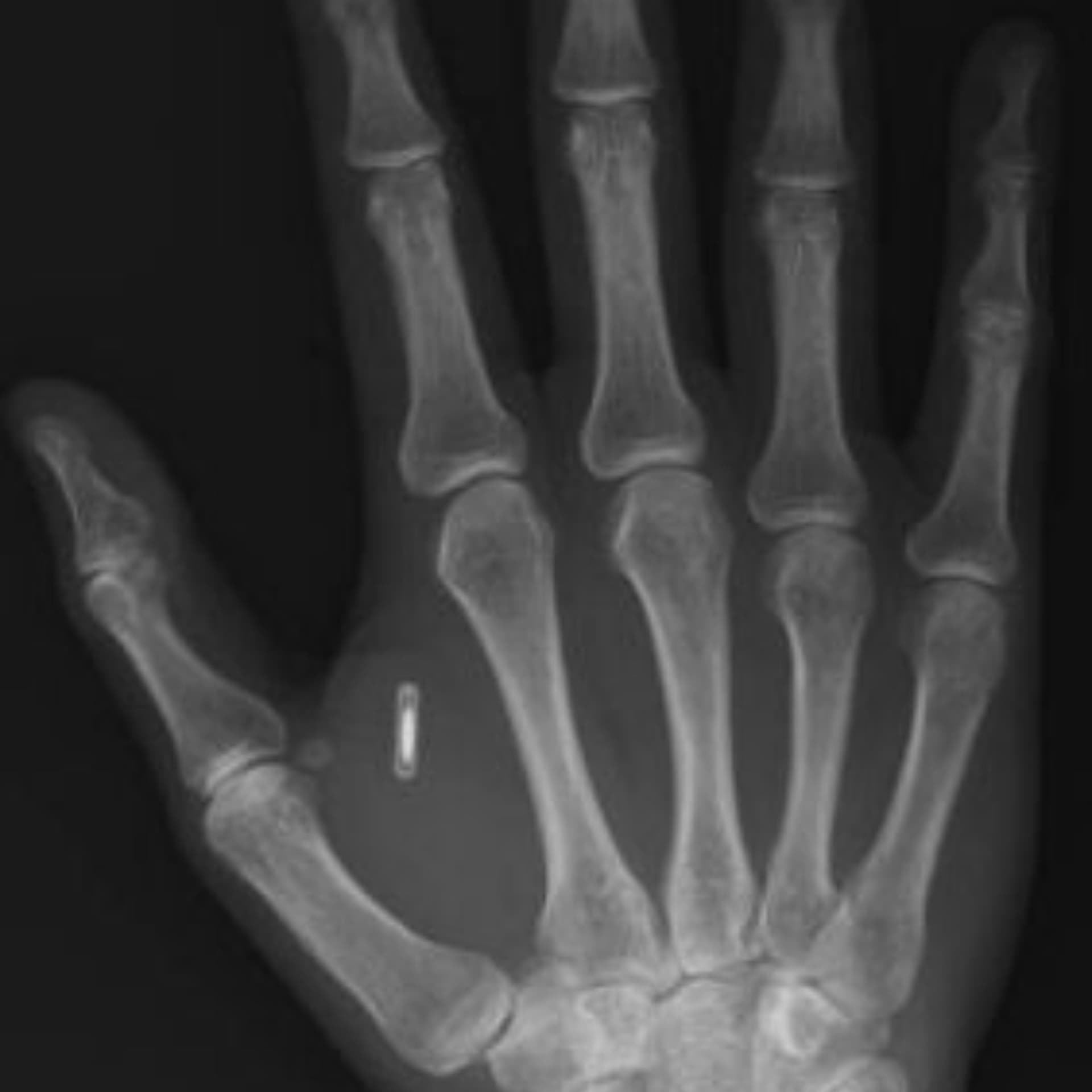 The Invisible Crime: Illegal Microchip Implants and Microwave Technology — Mysterious Radio: Paranormal, UFO and Lore Interviews cover