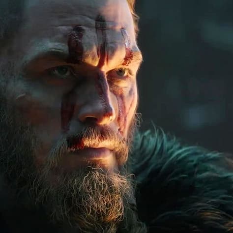 A haj meg a szőr még ma is nehéz ügy - TNT @index.hu cover