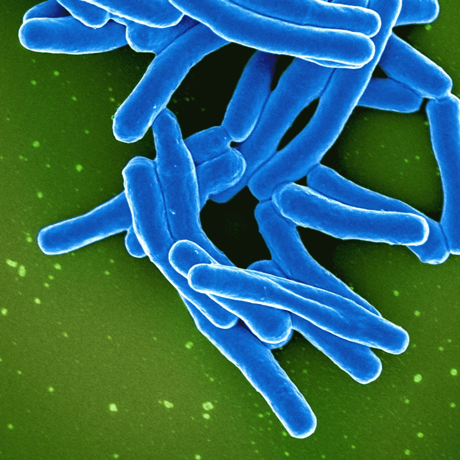 ID4U Episode 1 Tuberculosis Part 1 - ID4U - Infectious Disease Podcasts for Users of the CMES program cover