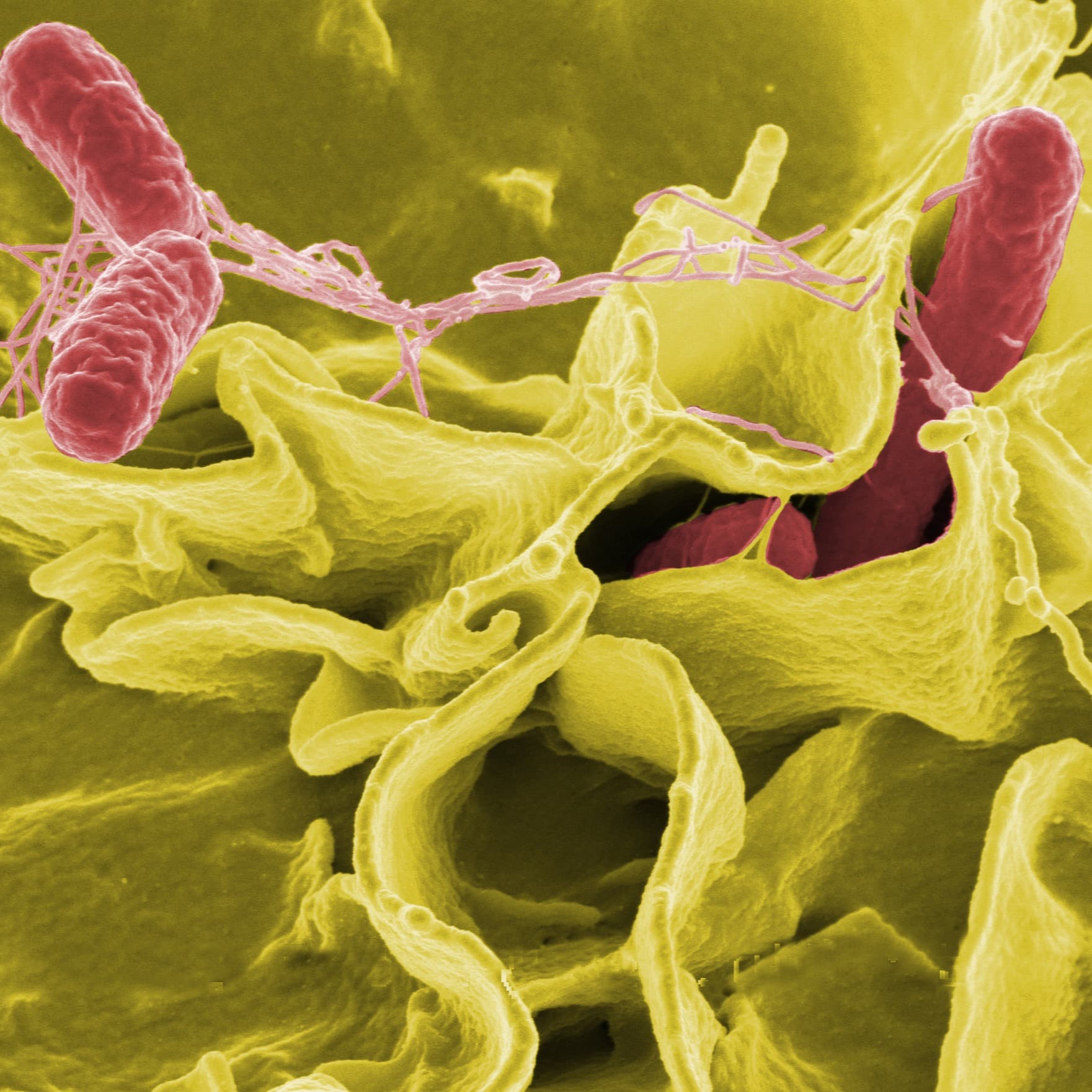 ID4U Episode 2 Typhoid Fever - ID4U - Infectious Disease Podcasts for Users of the CMES program cover