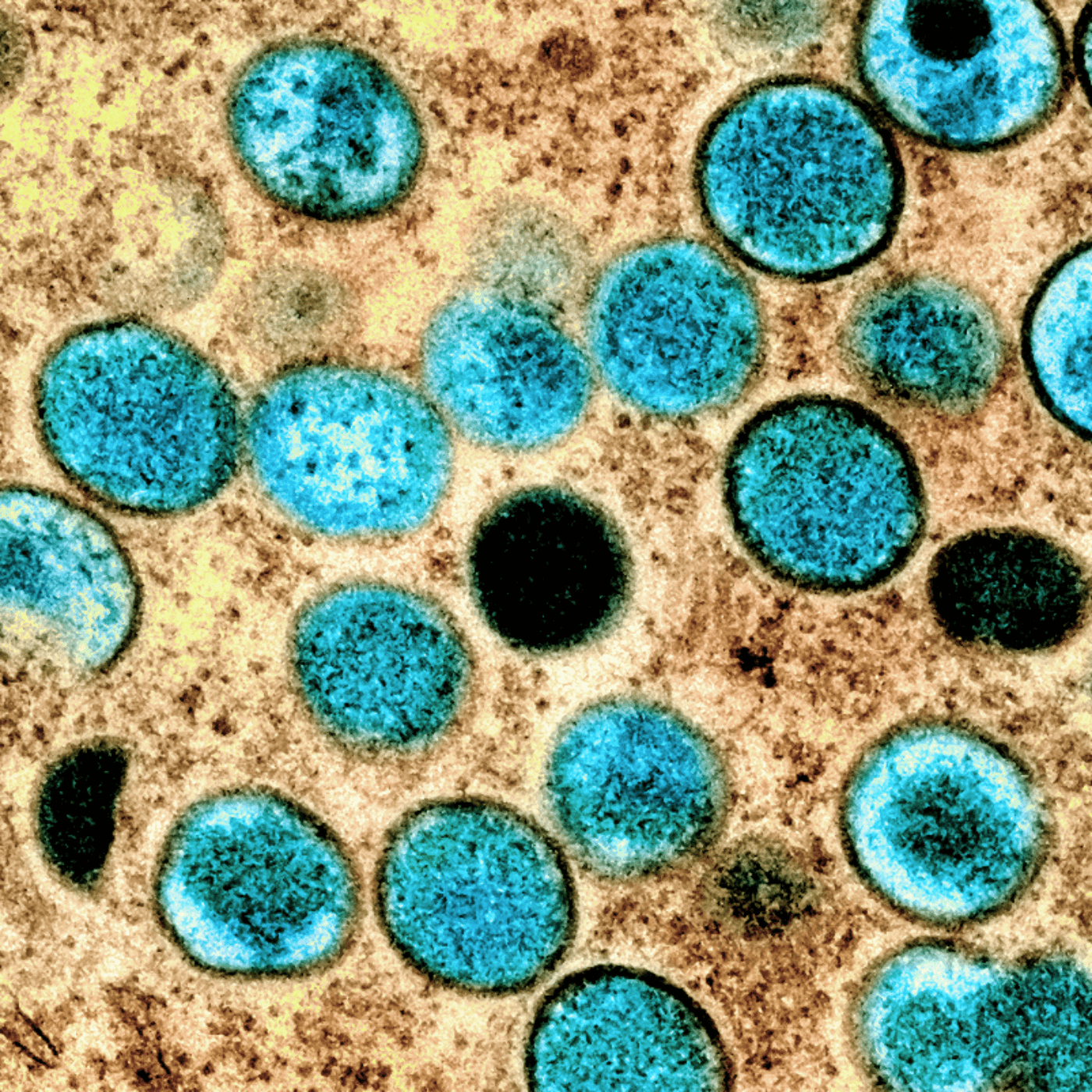 ID4U Episode 11 Mpox Part 2 - ID4U - Infectious Disease Podcasts for Users of the CMES program cover