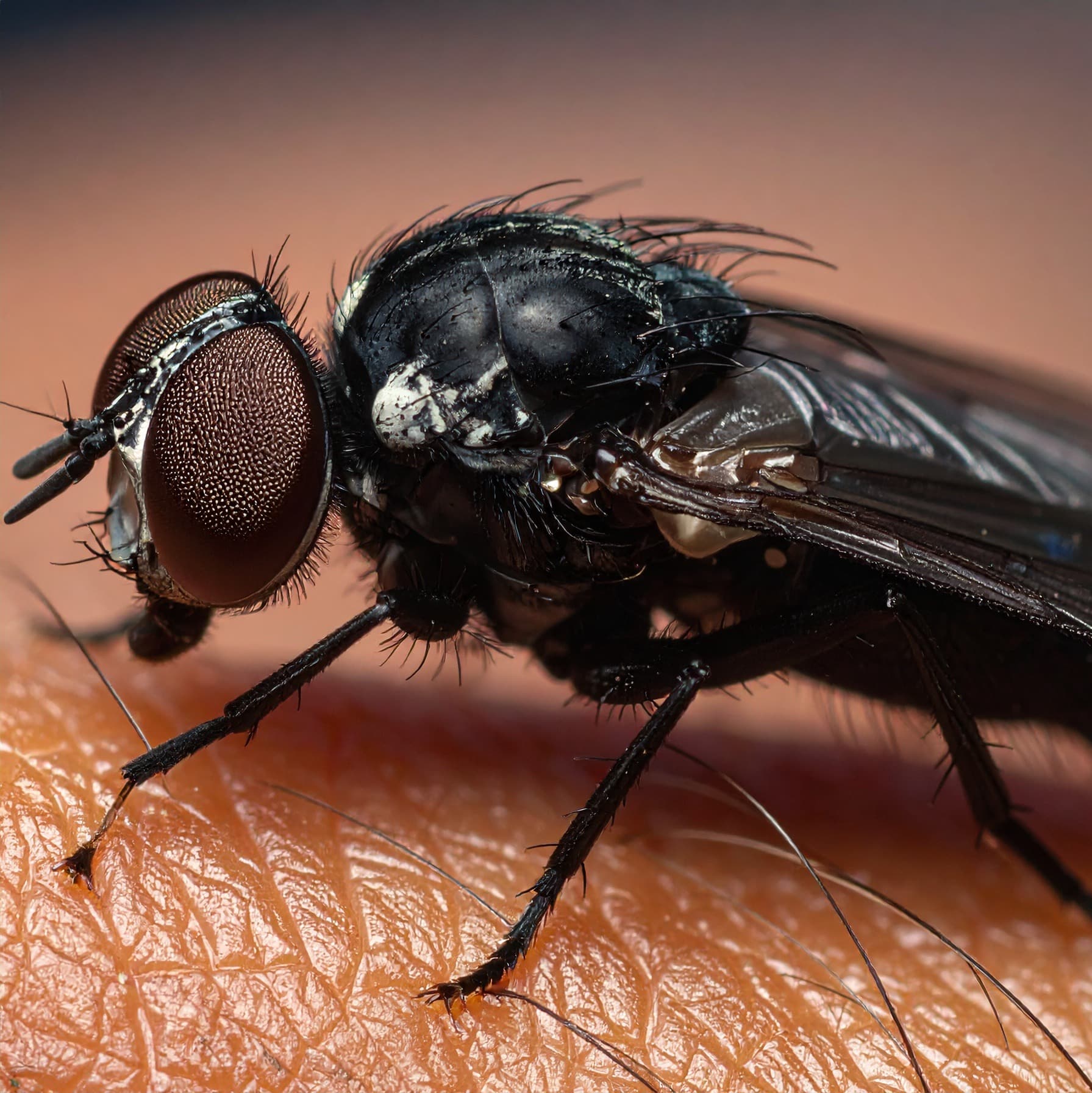 ID4U Episode 16 Onchocerciasis - ID4U - Infectious Disease Podcasts for Users of the CMES program cover