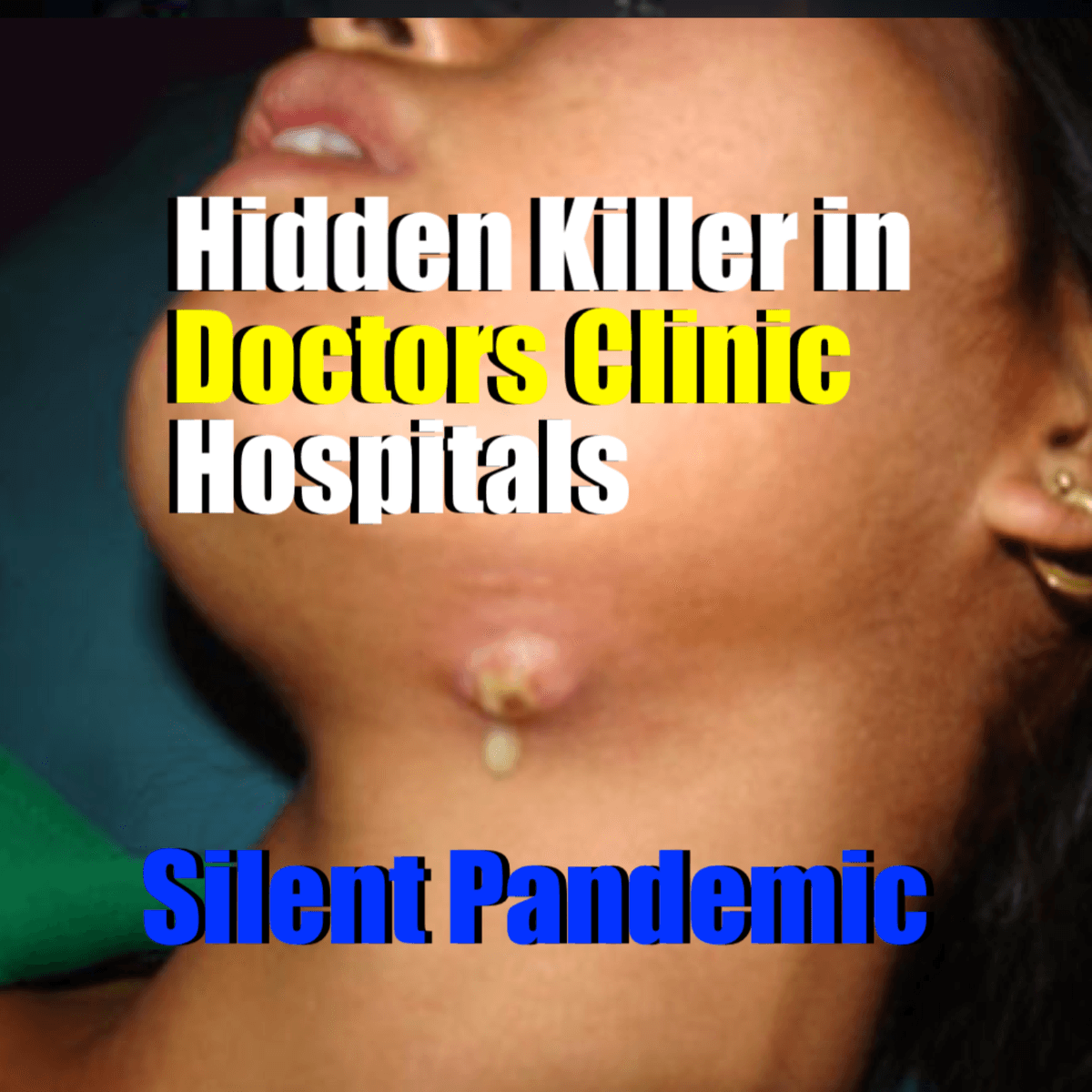 The Real Killer In The Waiting Room, the Doctors office, Hospital and Equipment threaten inpatients and visitors to Emergency Room - Fear Is the First Infection that Spread and Kill, and Not the Virus during Post-Antibiotic Era. cover