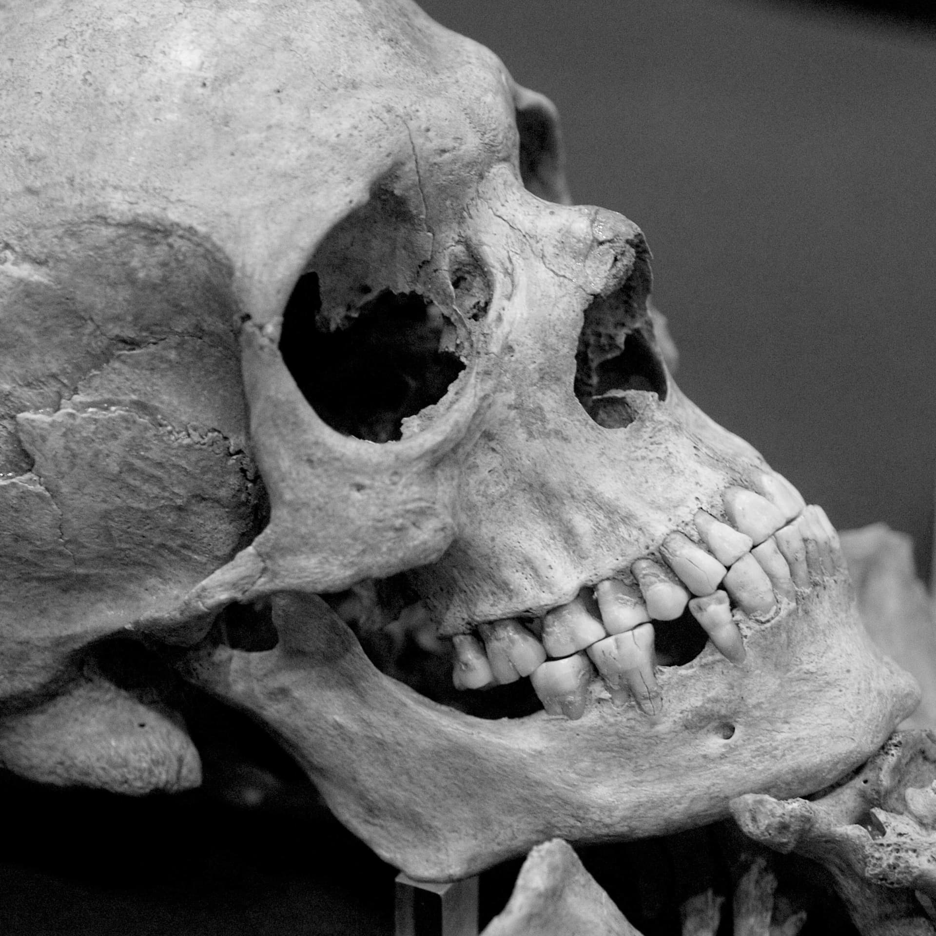 Postmortem, Ep. 5: A reckoning - Last Seen cover