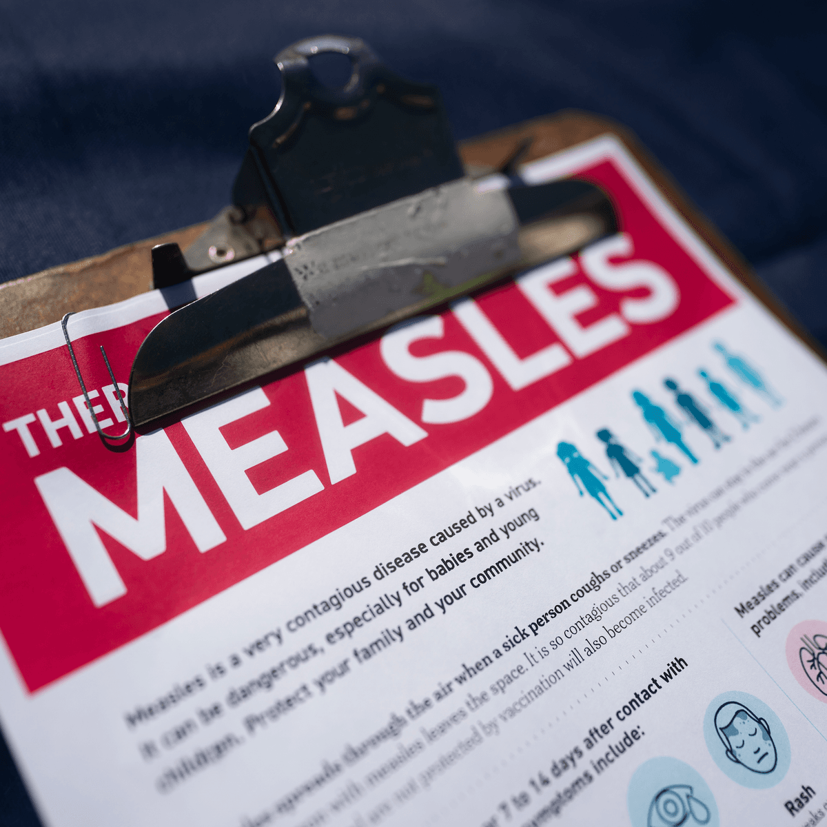 The measles is surging in the U.S. Here’s why — and where. - Apple News Today cover