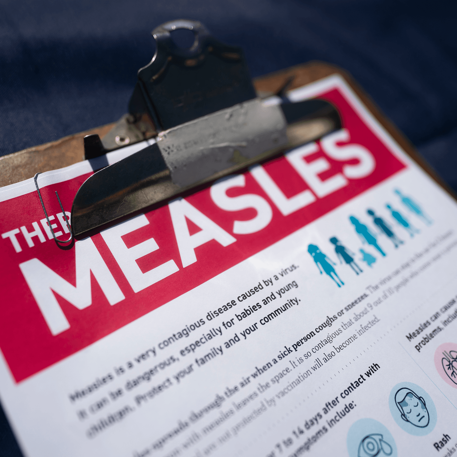 The measles is surging in the U.S. Here’s why — and where. - Apple News Today cover