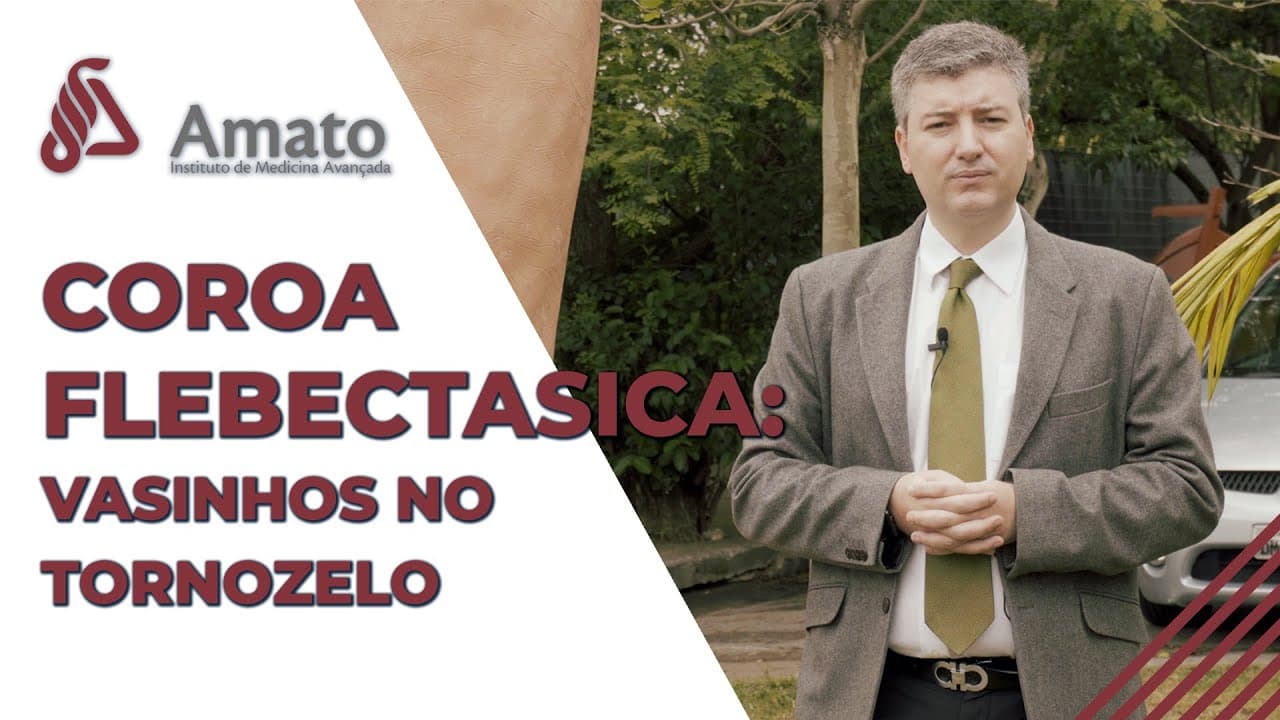 Vasinhos no tornozelo: Coroa flebectasica! - Amato PodCast cover