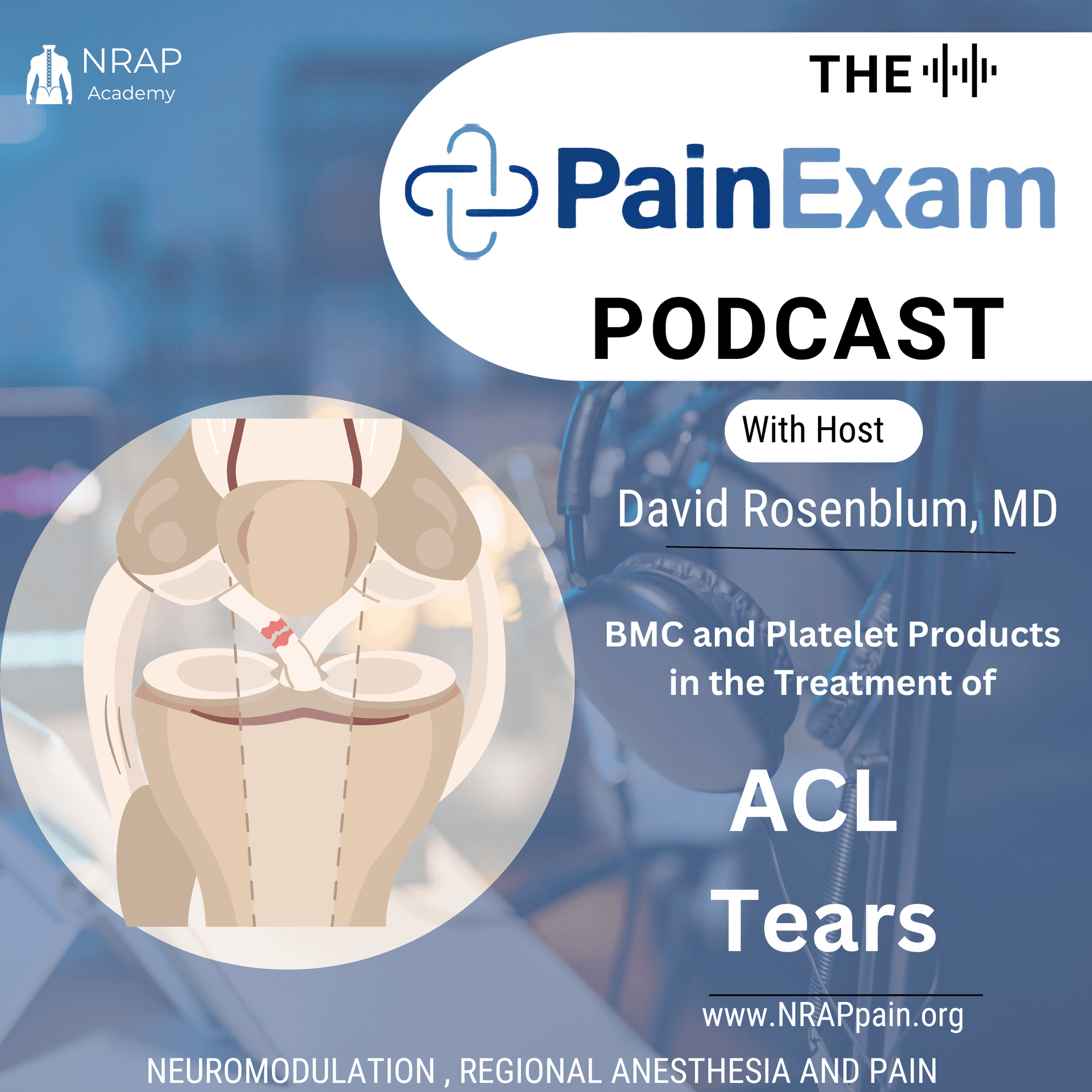 BMC and Platelet Products for ACL Tears: Journal Club - PainExam Podcast cover