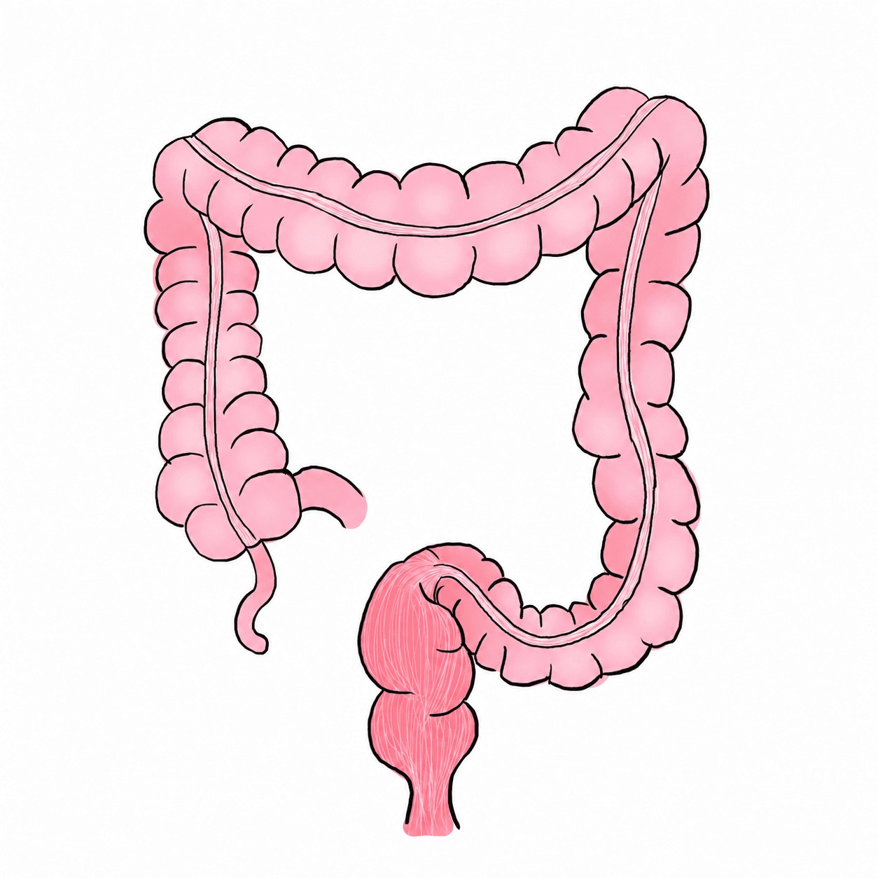 446. Surgical Management of Colorectal Cancer – Part 1 NOTES — Surgery 101 cover