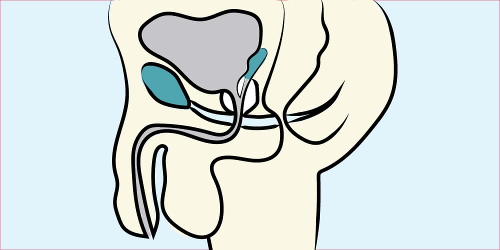 18. Urology: Pediatric Urology - Surgery 101 cover