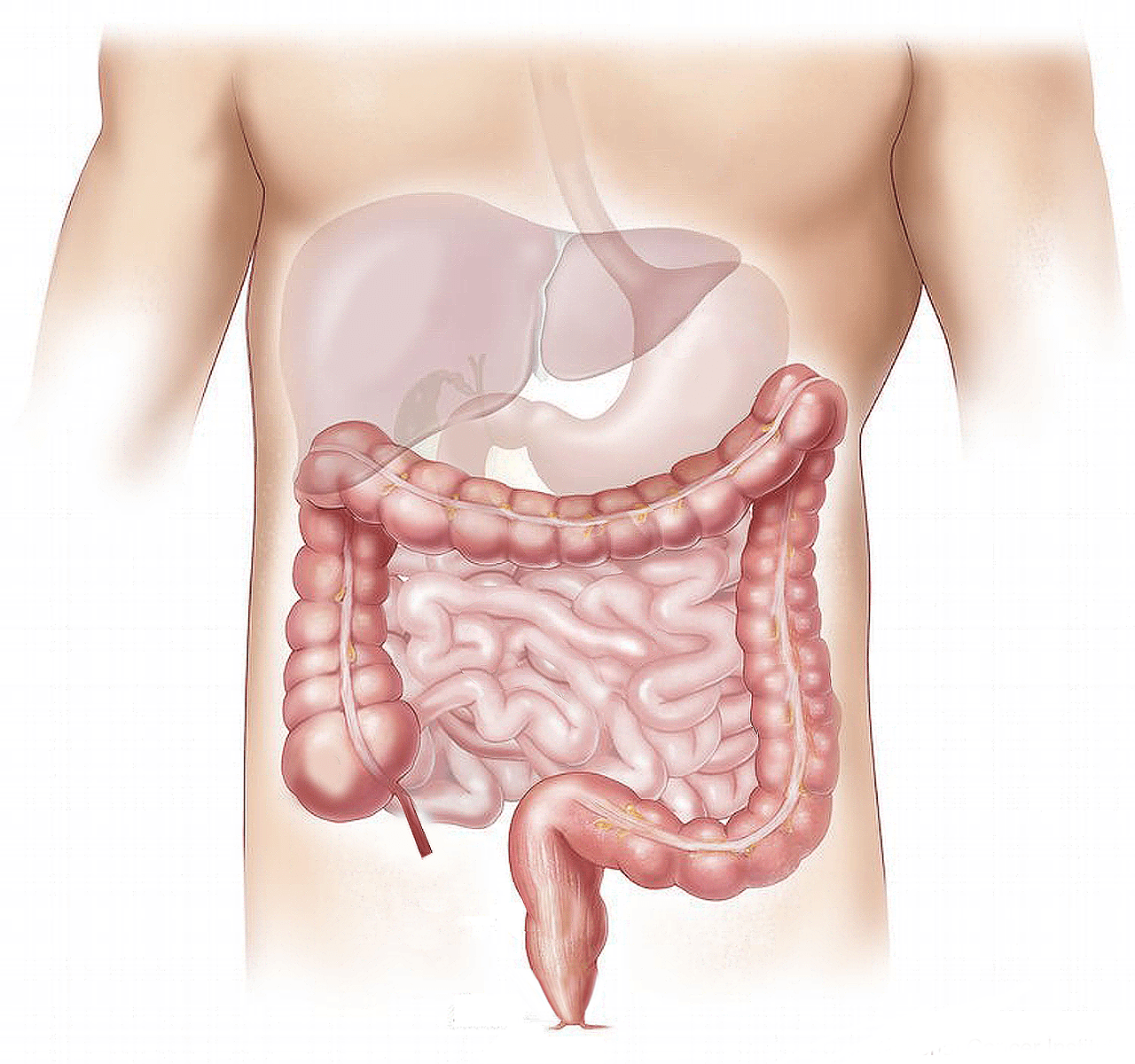 445. Recognizing Stomas NOTES - Surgery 101 cover