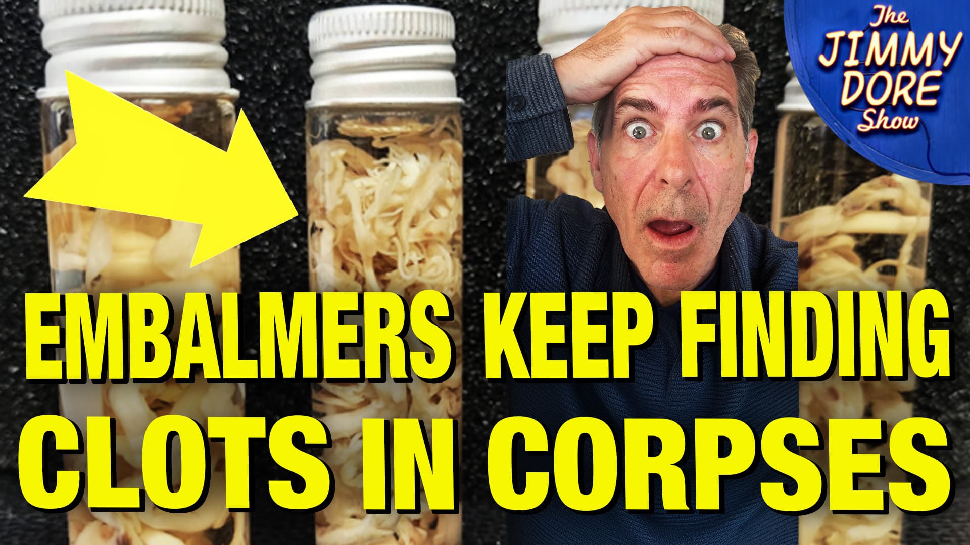Embalmers Report Persistent Blood Clots in Corpses Since COVID Vaxx Roll Out! — The Jimmy Dore Show cover