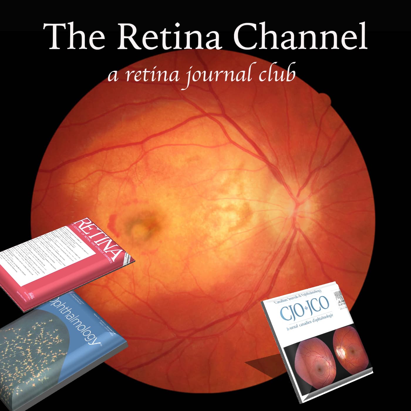 The Retina Channel Podcast cover