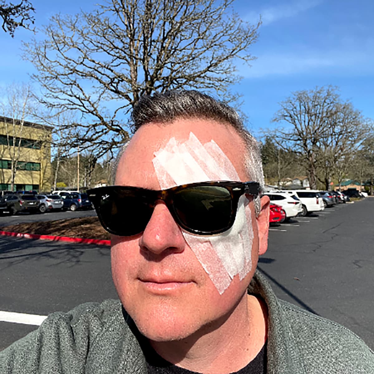 #4439 The Eyes Have It - TBTL: Too Beautiful To Live cover