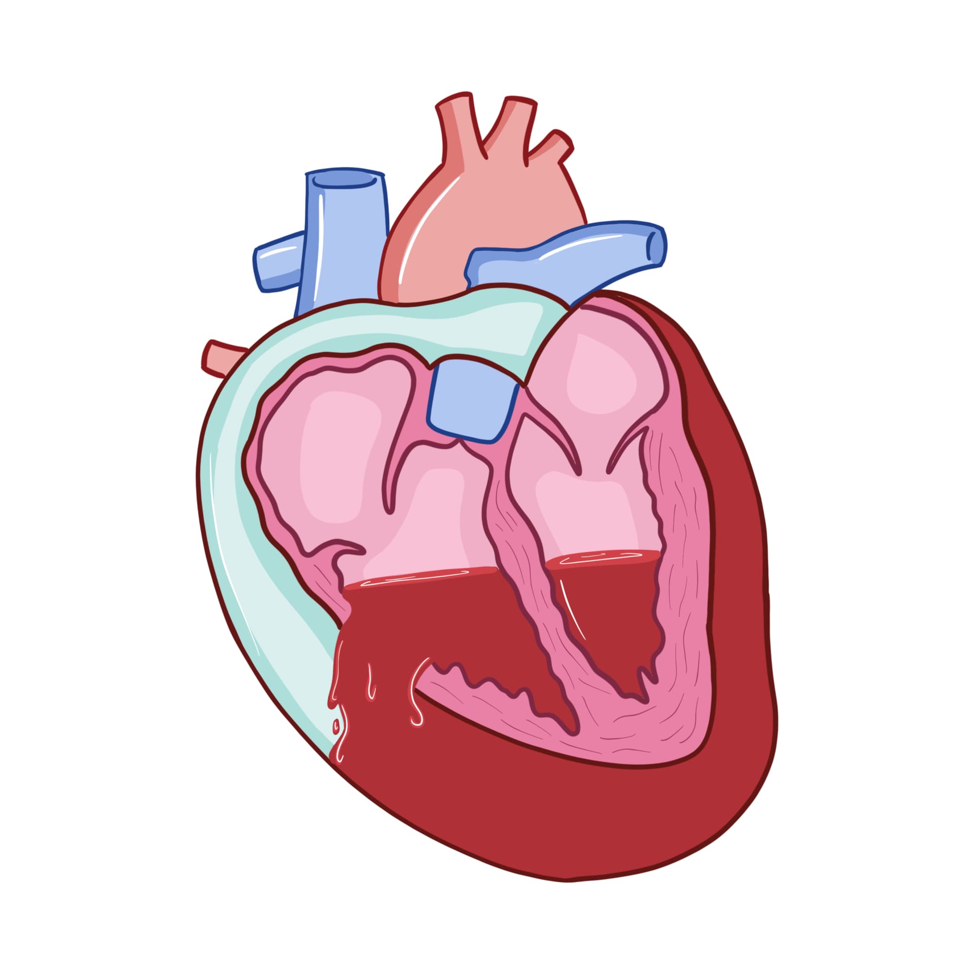 431. Cardiac Tamponade - Surgery 101 cover