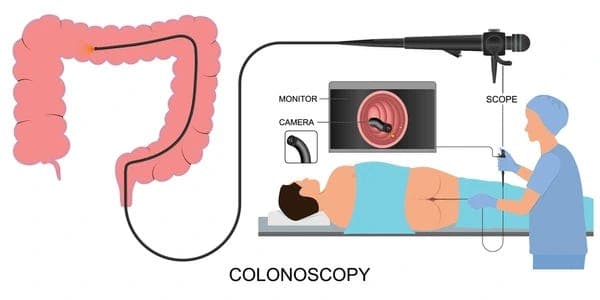 Episode 188: The One About The Colonoscopy - TheBrianLennonShow cover