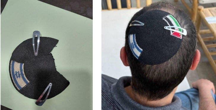 The kippah that roared (after it was assaulted) - Israel from the Inside with Daniel Gordis cover