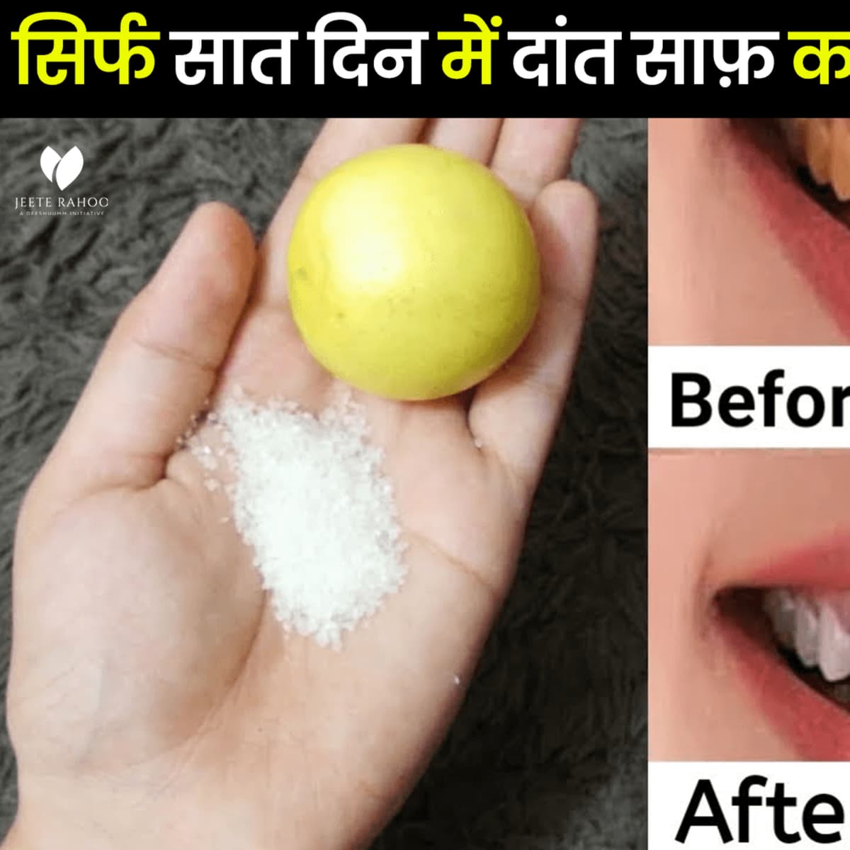Safed Daant 7 Din Mein | Safed Daant | Teeth Whitening | Daant Saaf Karne Ke Nuskhe - Pro Health Tips | Desi Nuske | Jeete Raho | Deeshuumm cover