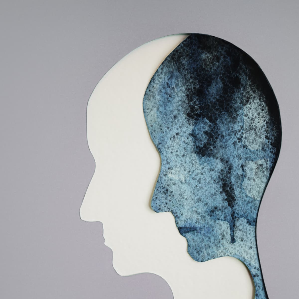 67. Destigmatizing Eating Disorders with Dr. Jennifer Gaudiani - Bendy Bodies with the Hypermobility MD cover